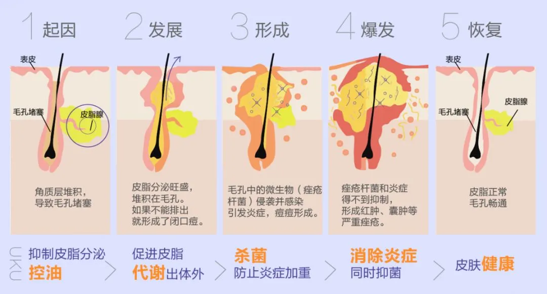 xinwen (3)